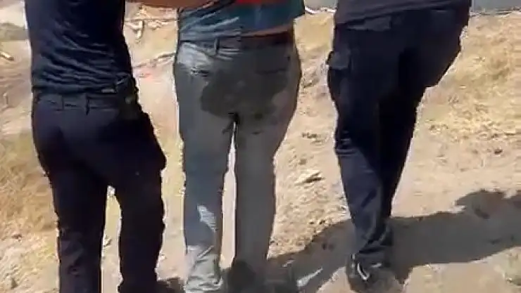 Kulağına saplanan demir profil ile hastaneye kaldırıldı